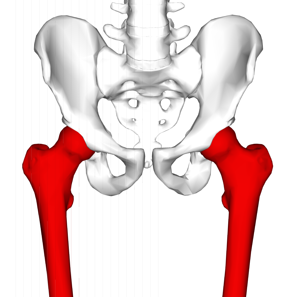 骨盤のズレが原因で股関節の痛みが出ていた患者さんの１症例